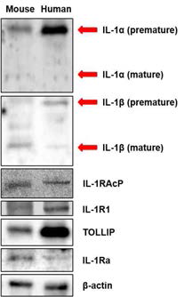 Expression of IL-1 system in mouse and human sperm