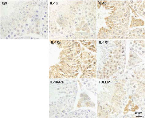 Localization of IL-1 system in mouse testis