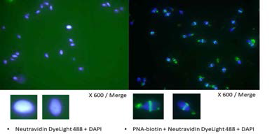 Sperm imaging using dye light 488-conjugated PNA via biotin-avidin