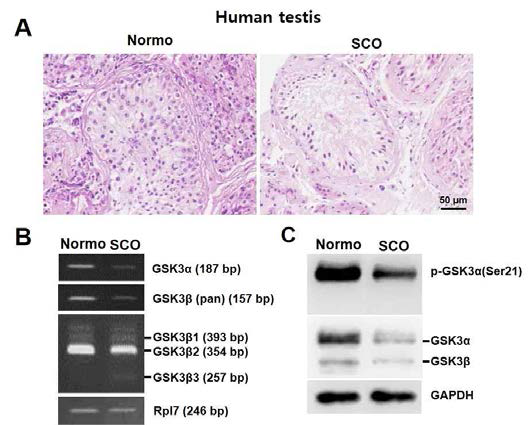 Histology of Normo and SCO testis (A) and expression of GSK3 mRNA (B) and protein (C)