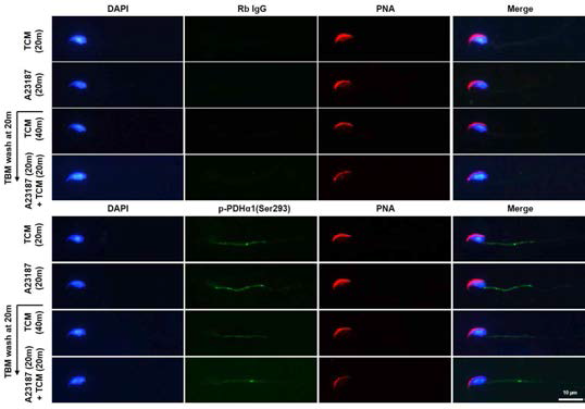 Immunolocalization of p-PDHα 1(Ser293) in A23187 (1 μM) treated mouse sperm before and after TBM washing