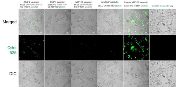 QD-based fluorescence images for monitoring MMP activity in living cells. Conjugates of QD-streptavidin with different biotinylated peptides (SGRSLSRLTA for MMP-2, VPLSLTMG for MMP-7, and IPVSLRSG for MMP-2 and MMP-9) were treated with HT-1080 cells. Images were captured 3 h after treatment. Scale bar is 20 μm