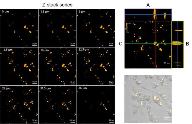 Z-stack confocal images collected at 4.5 μm sections in peptide-conjugated Qdot-treated cells. A is Z-projection in the X-Z direction, B is Z-projection in the Y-Z direction and the blue lines in A and B indicate the Z-depth of the 18 μm optical slice in C. The green and red lines in C indicate the orthogonal planes of the X-Z and Y-Z projection, respectively. Bottom right panel represents merged image at the Z-depth of 18 μm. Scale bar 20 μm