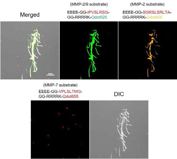 Multiplex image of MMP activities using three peptide-conjuged-Qdot probes in cauda epididymis sperm. Scale bar is 20 μm