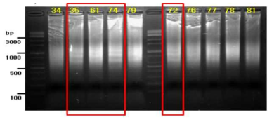 LM-PCR을 이용한 정자 DNA fragmentation 분석. 일부 환자에서 DNA fragmentation이 확연하게 관찰됨 (red box)