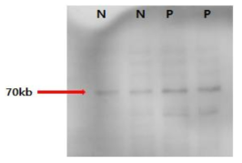 Western blot 결과