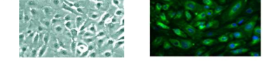 양막의 형태 조사 A. 단일세포층을 이룬 양막의 모양 B. 정상 양막 세포의 단일층에 나타난 E-Cadherine