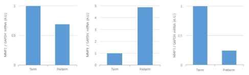 양막세포에서 MMP 발현 비교