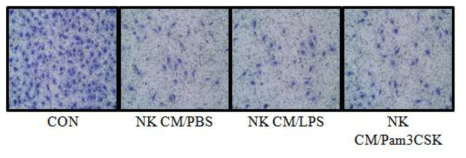 TLRs 리간드로 자극한 NK세포의 태반세포의 침윤 조절