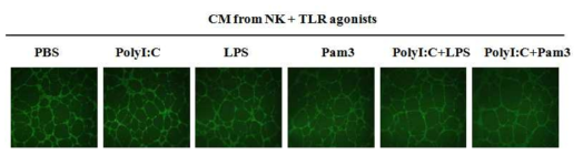 TLRs 리간드로 자극한 NK세포의 혈관재형성 조절