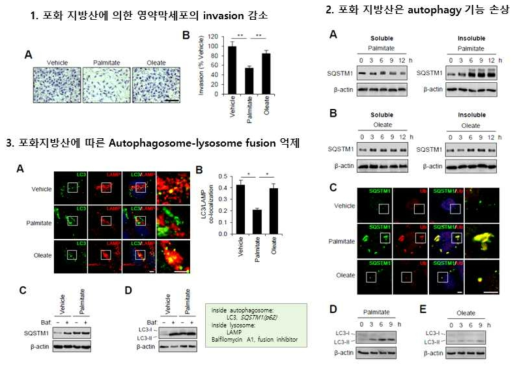 포화지방산은 autophagy손상과 영양막세포 침윤을 저해함