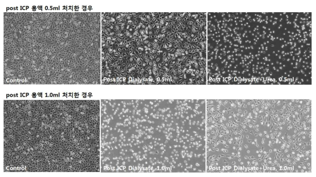 9차 In vitro cell toxicity test 결과. 깨끗한 복막투석액을 이용하여 Urea를 섞거나 섞지 않은 용액을 ICP에 통과 시킨 후, post ICP 용액을 L929세포 배양액에 treat하였을 때 48시간 후 보인 세포 독성 결과