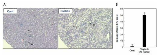 Cisplatin-induced kidney tissue injury and damage scoring on C57BL/6 mice after 3 days (H&E staining). G: glomerulus, T: tubular area, dT: damaged tubular area