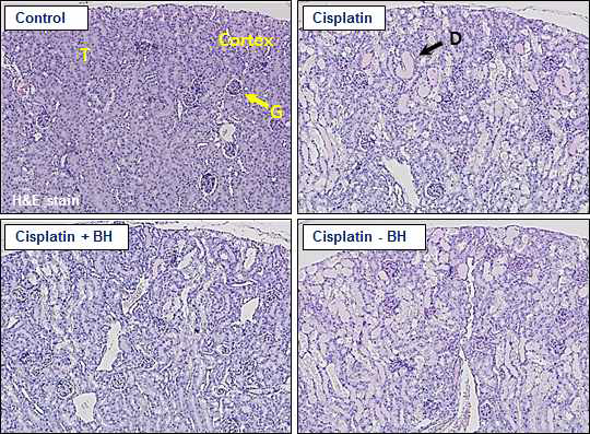 H&E staining of kidney tissues from cisplatin or herbal extract-treated mice. T: tubular region, G: glomerulus region, D: damaged region