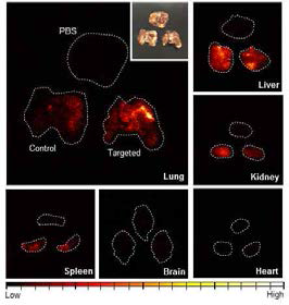 S.aureus에 의해 감염된 마우스 폐에 대한 선택적 약물 전달을 확인할 수 있는 time-gated imaging 결과