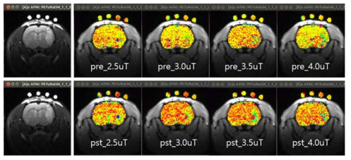 Brain tumor rat model에서의 RF pulse power 변화 및 iopamidol에 주입전(上)/후(下) CEST effect