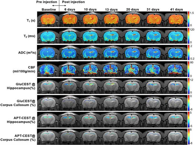 Multi-parametric MRI map 기반 다발성경화증 동물모델에서의 대사현상 추적관찰