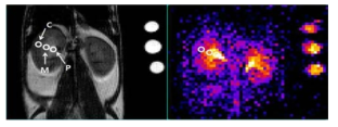 정상 쥐의 T2w 영상 (좌) mouse kidney의 나트륨분포영상(우)의 Color map. 신장에서의 pelvis(P)/medulla(M)/cortex(C)에 따라 나트륩의 분포를 뚜렷하게 구분할 수 있다. T2w에서 ROI를 정하여 나트륨 분포영상에서 동일한 ROI에 대한 신호세기 (Signal Intensity)를 측정하고 ROI내 나트륨 농도를 계산하였음