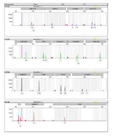 NCI-H460 인간폐암세포주 염색체의 STR 분석 결과
