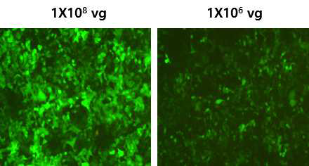 GFP 발현 AAV 바이러스 합성 및 감염확인