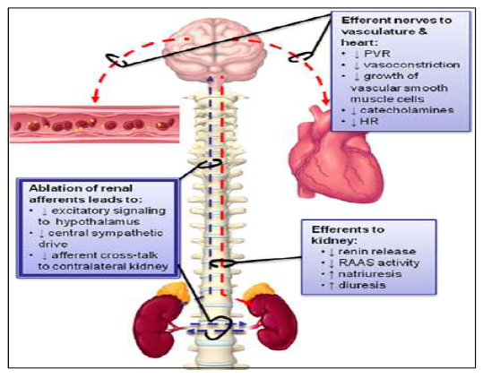 교감신경계 pathway (JACC Cardiovasc Interv.2013 Jan;6(1):1-9)