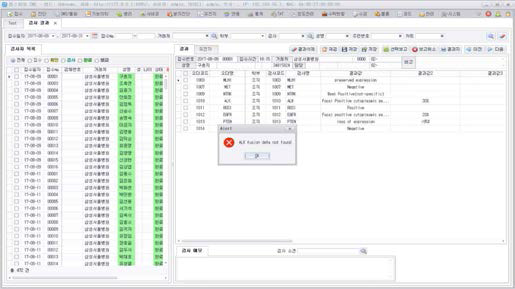 ALK positive 샘플에 fusion이 없는 경우의 alert창