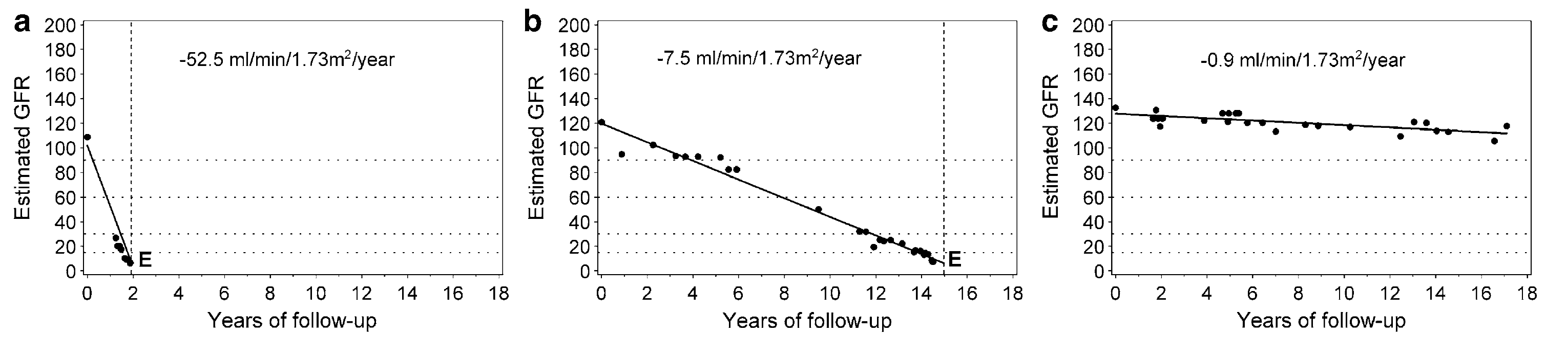 당뇨병과 현성단백뇨가 있는 환자에서 Progressor(a, b)와 Non-progressor(c)의 예 (Clin Exp Nephrol. 2014)
