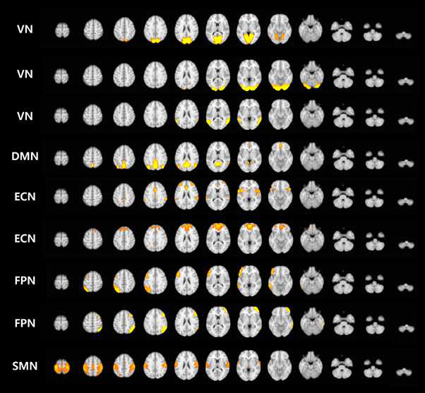 Nine brain networks generated using group-ICA. VN, visual network; DMN, default mode network; ECN, executive control network; FPN, frontoparietal network; SMN, sensorimotor network