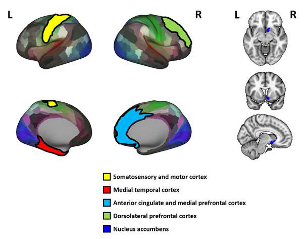 Five brain regions that showed significant between-group differences between the rTMS and SHAM groups