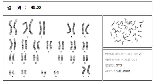 전기자극에 의해 분화된 유도연골세포의 핵형분석 결과