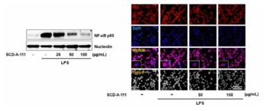 미세아교세포에서 NF-κB p65 발현에 대한 영향