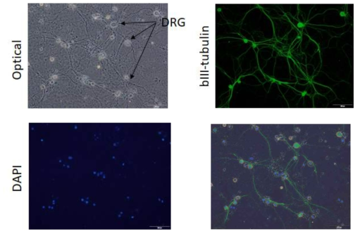 DRG 세포와 신경세포 마커인 βIII-tubulin 형광 염색