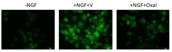 NGF로 분화 유도된 PC12 세포에서 GAP43 단백질 발현