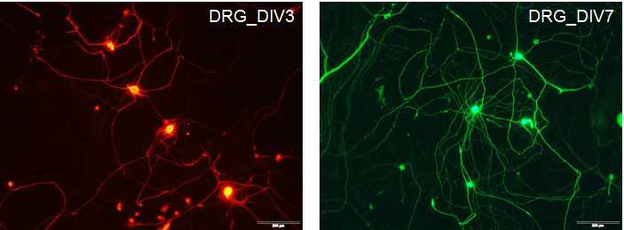 NGF 투여 3일과 7일 후의 DRG 세포 neurite outgrowth