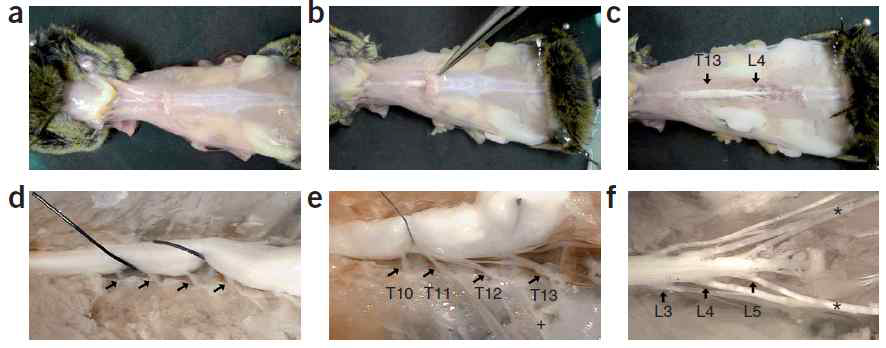 Positioning of L3-L5 from mouse spinal column, Malin SA et al., 2007, Nature Protocol