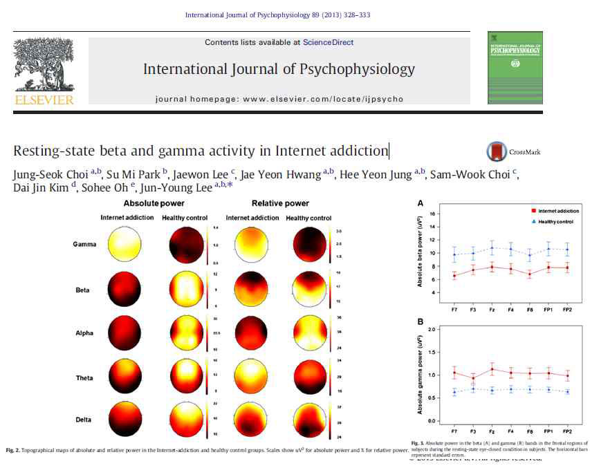 일반인과 인터넷 중독 환자의 EEG power 차이 (Choi et al., 2013)