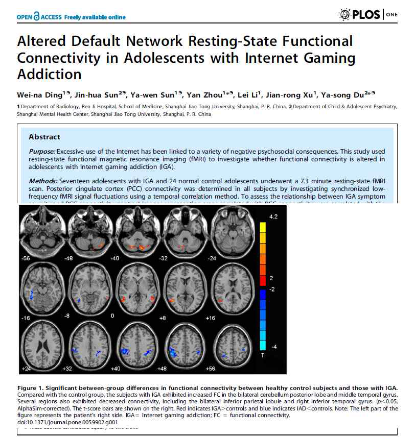 일반인과 인터넷 게임 중독 청소년의 뇌 활성화 (Dong et al., 2013)