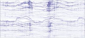 Raw EEG data