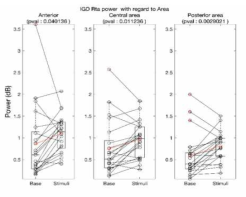 IGD 군의 Theta/alpha ratio