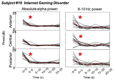 최적 지표를 적용한 Subject 의 power 리듬