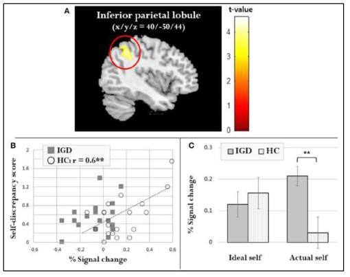 자기상 평가 과제 중의 inferior parietal lobe 활성화 군 간 비교