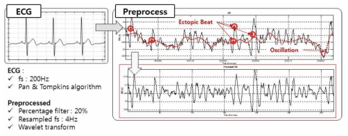 Heart Rate Variability(심박변이도) Pre-Processing