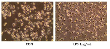 Representative image of morphological change in RAW264.7 cells after LPS treatment