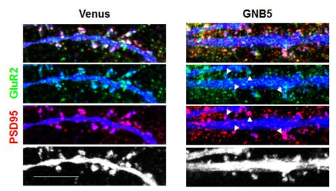 The results of co-localization of GNB5 and PSD95 or GluR2 in primary cultured neuronal cells
