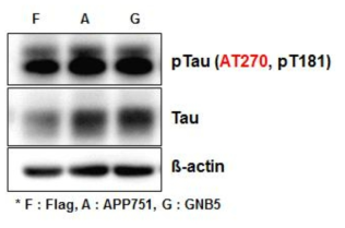 The status of tau phosphorylation in SH-SY5Y cells overexpressing genes indicated