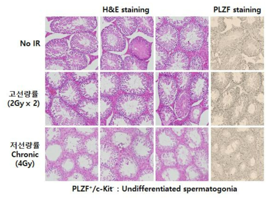 저선량률 및 고선량률 방사선 조사된 고환에서 PLZF staining 수행 결과