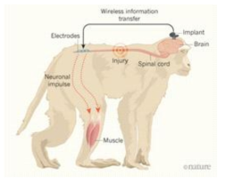 Brown대학에서 발표한 “A wireless implant bypasses spinal-cord injuries in monkeys, enabling them to move their legs