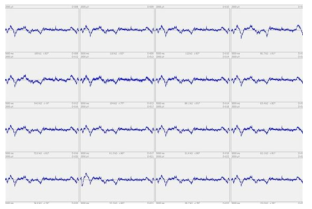 SU-8/FEP 16 채널 ECoG 를 이용해 측정된 EEG 신호