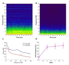 SU-8/FEP 16 채널 ECoG를 이용해 측정된 EEG 신호의 안정성