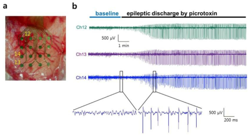 쥐에 이식된 제작된 ECoG 전극의 발작 신호 검출 성능